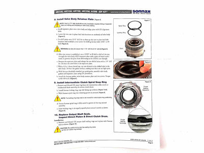 Zip Kit Sonnax 4R70E 4R70W 4R75E 4R75W 1996/UP